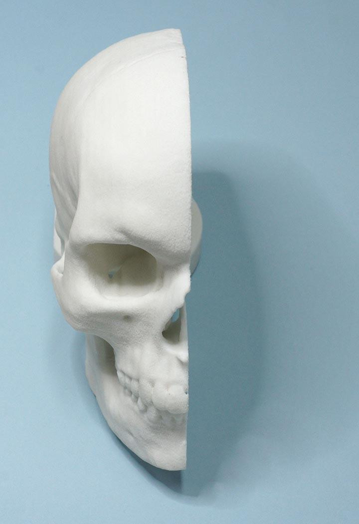 Przykładowe implanty Chirurgia 3D