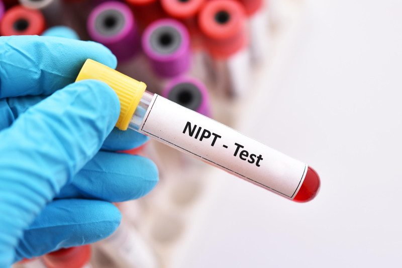 Testy NIPT pomagają ujawnić poważną chorobę lub uszkodzenie płodu.