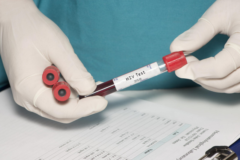 Testy w kierunku HIV są bezpłatne w Norwegii we wszystkich ośrodkach medycznych finansowanych ze środków publicznych.