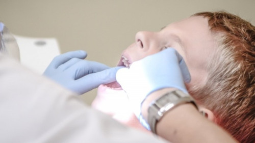 Zwykła próchnica czy już zaniedbanie? Dentyści zgłaszają Barnevernet coraz więcej dzieci